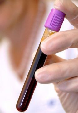 Анализ крови на гормоны: как подготовиться и чего ожидать?