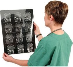 Турецкое седло: что это, почему оно бывает пустым?