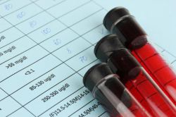 Иммунограмма: что показывает, где сделать, расшифровка результатов