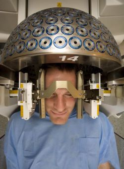 Гамма-нож: показания, эффективность, лечение и последствия после операции