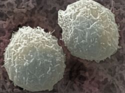 Лейкоциты в крови: их виды и функции