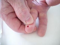 Что означает анализ СОЭ повышенное?