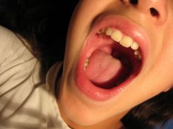 Осиплость голоса: лечение, причины и симптоматика