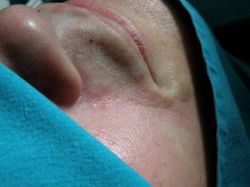 Почему носогубный треугольник синий?