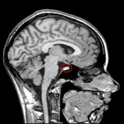 Почему ТТГ повышен? 
