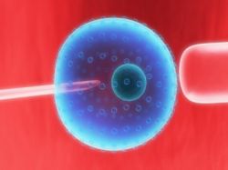 Лекарство «Золадекс»: инструкция по применению и описание