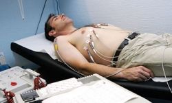 Фибрилляция предсердий как разновидность сердечной аритмии