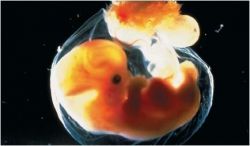 Что такое бипариетальный размер?