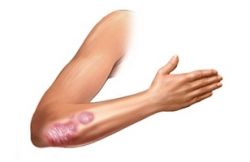 Препарат «Пантенол» (мазь)