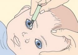 Средство «Зовиракс» (мазь). Инструкция