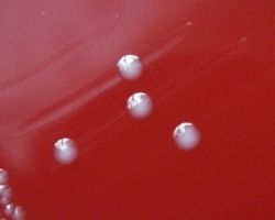 Энтерококк фекальный – нужно ли беспокоиться?