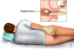 Помогают ли свечи при геморрое при беременности?