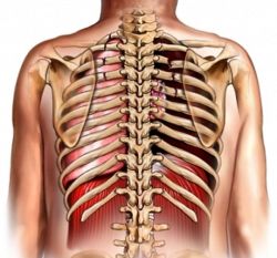 Лечение переломов ребер, причины и симптоматика