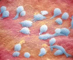 Моноциты в крови повышены: основные причины 