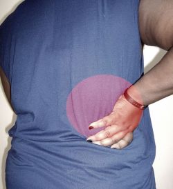 Пиелонефрит: симптомы острого и хронического заболевания