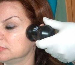 Для чего применяется фонофорез с гидрокортизоном, карипаином и лидазой?