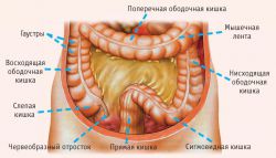 Расположение сигмовидной кишки, заболевание и методы лечения
