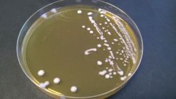 Лактобактерия Lactobacillus spp: особенности, расшифровка и норма