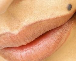 Какую угрозу несет в себе уплотнение под кожей?