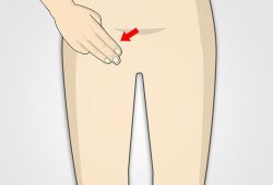 Паховые лимфоузлы: общее описание, проблемы, диагностика