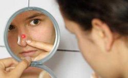 Прыщ на носу, примета такая есть