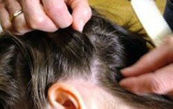 Откуда берутся вши постельные и как с ними бороться? 