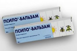 Укус комара у ребенка: как устранить последствия? Реакция на укус комара у ребенка